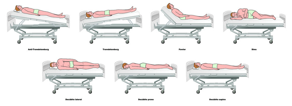 Posiciones paciente en cama hospitalaria - enfermería vector de Stock |  Adobe Stock