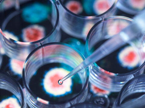 Close-up of pipette placing experimental vaccine into microplate