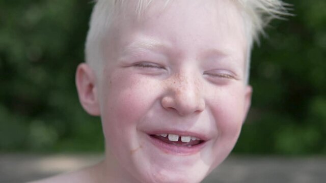 A close-up of the face of a young boy who burned in the sun is blond. Happy baby laughs, slow-motion shoot