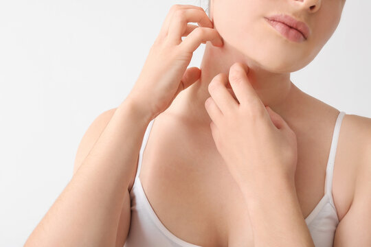 Young Woman Scratching Her Skin On Light Background