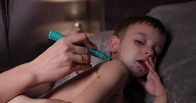 not a happy boy sick with chicken pox lies in bed on his side. mother puts a marker green aunt on pimples of chicken pox.