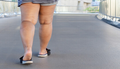 Legs of woman in sandals is walking on the street alone.