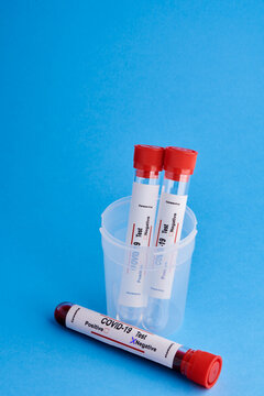 From above closeup of test tubes with blood samples in plastic cup for coronavirus diagnostic test with negative mark placed on blue background