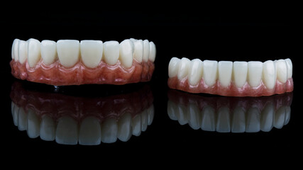 excellent dental composition of prostheses with a pink gum for the lower and upper jaws, shot on a black background with reflection