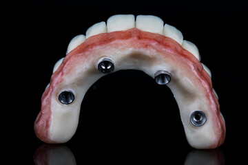 high-quality denture for the upper jaw with a pink gum from the fixation side, shot on a black background © Dental Pro Content