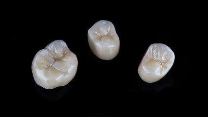 three dental crowns made of quality ceramics and anatomy of chewing teeth, shot on a black background