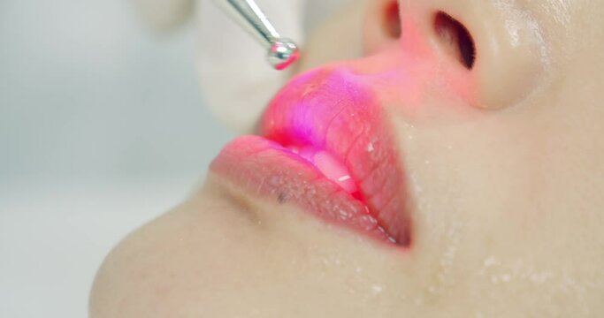 a close up shot of lip-free lip augmentation with innovative technic 