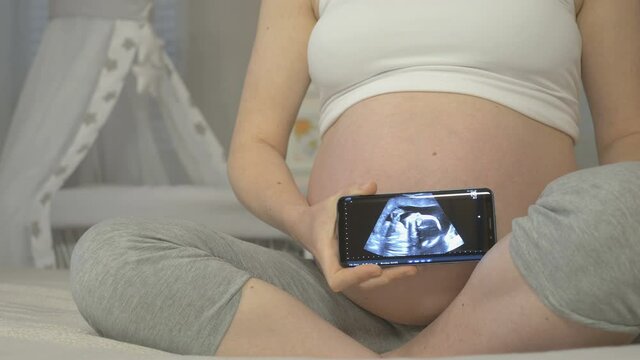 Nine months of pregnancy, conceptual footage. A pregnant woman is holding a smartphone with an ultrasound examination of her unborn baby screen.