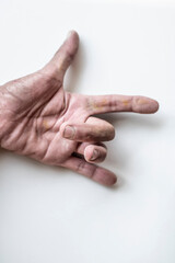 The finger of an elderly person who is sick, the trigger lock finger