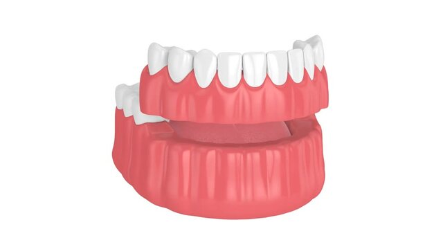 Partial denture isolated over white background

