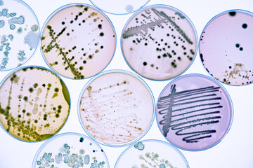 Mixed of bacteria colonies and fungus in various petri dish