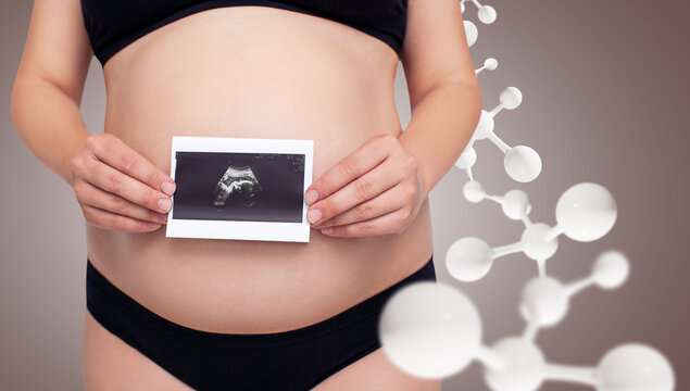 Pregnant woman holds ultrasound picture among white molecules chain.
