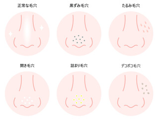 鼻の毛穴　セット　種類