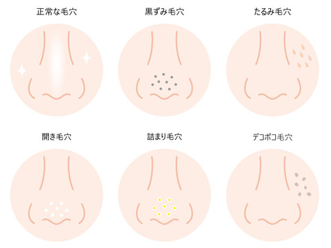 スキントラブル Photos Royalty Free Images Graphics Vectors Videos Adobe Stock