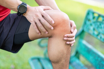 Young adult male with muscle pain during running. runner have knee ache due to Runners Knee or...
