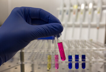 Biologist holding test tube with chemicals