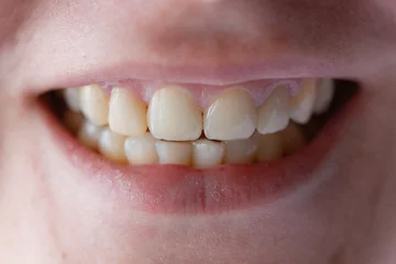 Fotobehang Woman's mouth with white teeth. © Albert Ziganshin