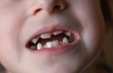 Close up portrait of toddler without milk teeth.