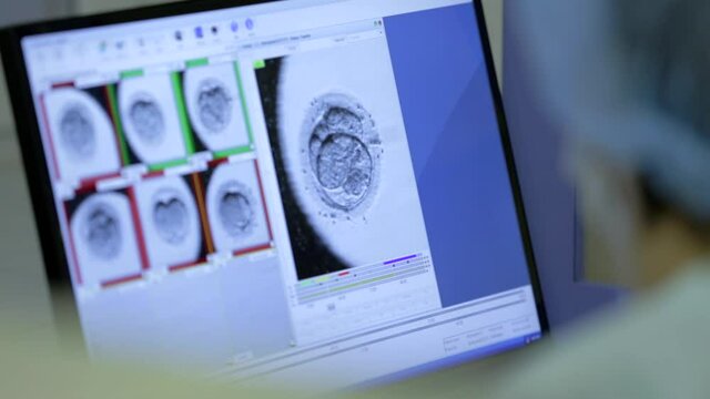 Medical Laboratory. On Monitor few Snapshots Germ of man. Artificial Ovum Fertilization. Doctors Discuss IVF Success. Learn Cell Division Process. Science. Expensive Artificial Insemination Procedure