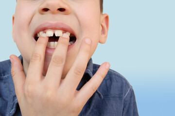 child, kid shows with his finger a milk tooth that sways and hurts, the concept of pediatric...