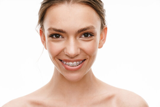 Image of beautiful caucasian young shirtless woman wearing braces