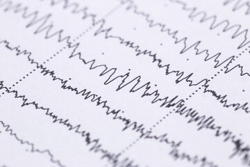 Cardiogram on a sheet of paper close-up. Texture of pulsed waves.