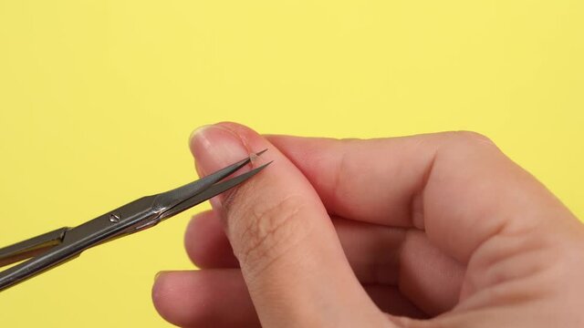 Closeup view 4k video footage of  female hand with bad long dirty nails and dry painful skin cuticle. Woman cuts away ugly hangnails using scissors.