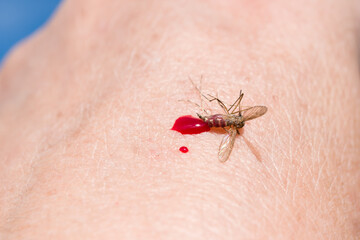 The insect killed the mosquito drank the blood of the human skin close-up, macro