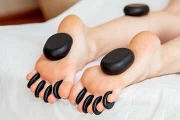 Large new oval black hot stones for back massage lying on female feet and between toes in spa salon