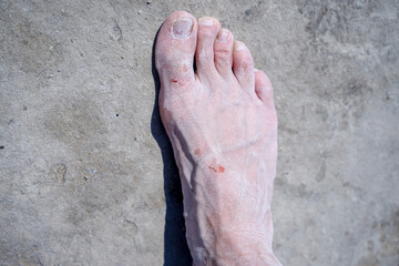 Bare feet of men in the pink salt lake. Salt Deposit. Treatment of wounds with salt. Healing properties of salt.