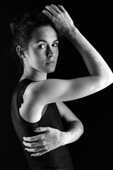 Vitiligo on the hands. Young beautiful woman with vitiligo.