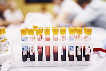 Scientist in laboratory with blood test tubes