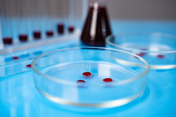 Petri dishes and Test tubes with blood samples on table in laboratory