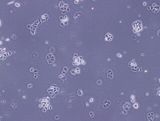 Human Breast Adenocarcinoma Cells or Human Breast Cancer Cell (MCF-7 Cells) were captured by Light Microscope (40x).