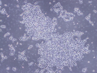 Human Brain Endothelial Cells (hCMEC/D3 cells) were captured by Light Microscope (40x)