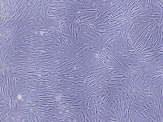 Fibroblasts ,the most common cells of connective tissue in animals, were captured by Light Microscope (40x)
