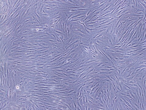 Fibroblasts ,the most common cells of connective tissue in animals, were captured by Light Microscope (40x)