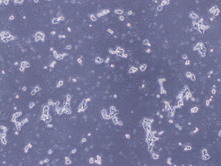 Human Brain Endothelial Cells (hCMEC/D3 cells) were captured by Light Microscope (40x)