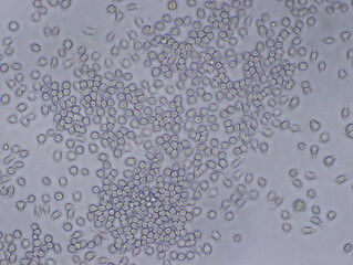 Mouse Macrophage Cells (TIB-67 Cells) were captured by Light Microscope (100x).
