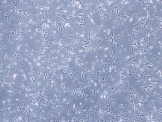 Human Brain Endothelial Cells (hCMEC/D3 cells) were captured by Light Microscope (40x)