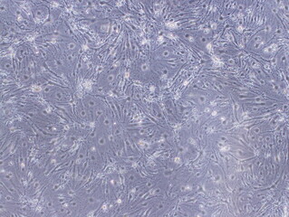 Mouse Cerebral Endothelial Cells (bEnd3 cells) were captured by Light Microscope (40x)