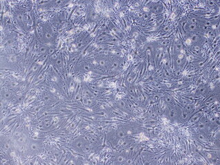 Mouse Cerebral Endothelial Cells (bEnd3 cells) were captured by Light Microscope (40x)