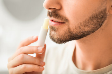 Handsome young man with lip balm at home, closeup