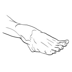 Foot drawn for podiatry problems. Fingers and nails to be restored for the podiatrist