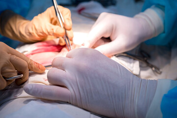 surgical suture. The hands of the surgeon and assistant in a sterile operating room impose a cosmetic suture on the skin of the patient's child.