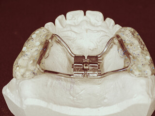 Upper jaw bracket braces model on dentist table © rdonar
