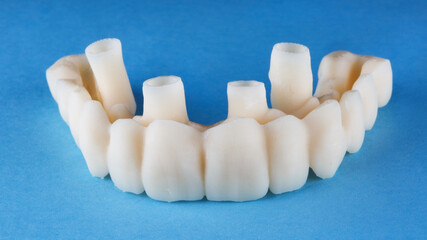 temporary dental prosthesis for fixation on the upper jaw, shot on a blue background