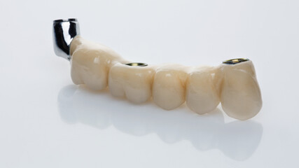 ceramic dental bridge of five teeth on a titanium basis for orthopedic surrender, shot on a white background