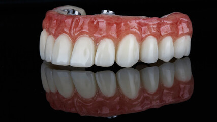 excellent prosthesis with artificial gum and anatomy, shot on a black background