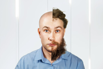 Man with half shaved beard and hair head. Guy before and after transplant and alopecia. Isolated on white background - obrazy, fototapety, plakaty